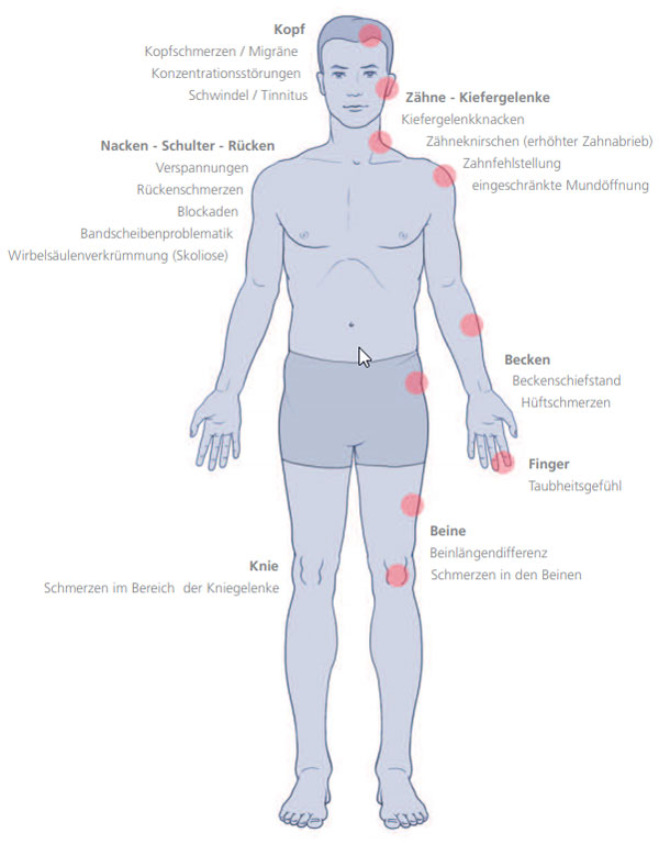 Verspannung der Hals-, Nacken- und Schultermuskulatur · CMD-Westfalen