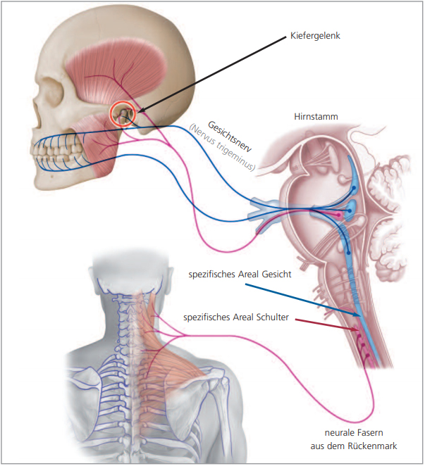 Verspannung der Hals-, Nacken- und Schultermuskulatur · CMD-Westfalen